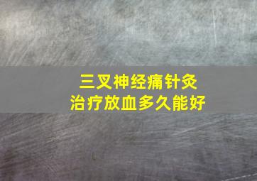 三叉神经痛针灸治疗放血多久能好