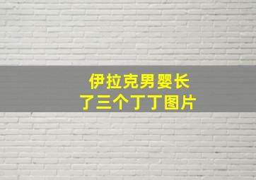 伊拉克男婴长了三个丁丁图片