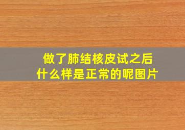 做了肺结核皮试之后什么样是正常的呢图片