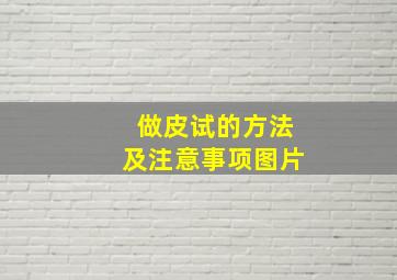 做皮试的方法及注意事项图片