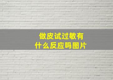 做皮试过敏有什么反应吗图片