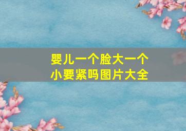 婴儿一个脸大一个小要紧吗图片大全