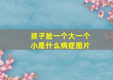 孩子脸一个大一个小是什么病症图片