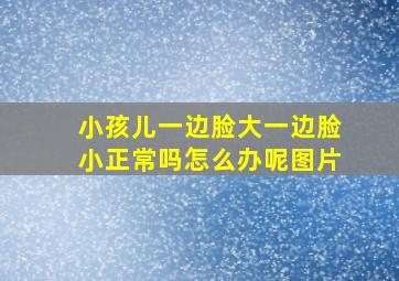 小孩儿一边脸大一边脸小正常吗怎么办呢图片