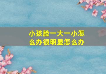 小孩脸一大一小怎么办很明显怎么办