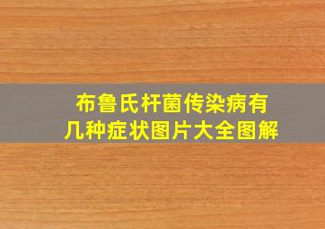 布鲁氏杆菌传染病有几种症状图片大全图解