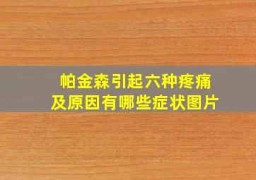 帕金森引起六种疼痛及原因有哪些症状图片