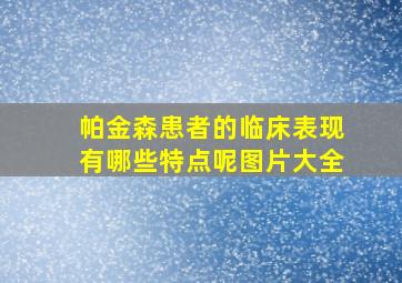 帕金森患者的临床表现有哪些特点呢图片大全