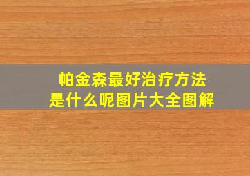 帕金森最好治疗方法是什么呢图片大全图解