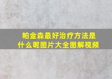 帕金森最好治疗方法是什么呢图片大全图解视频