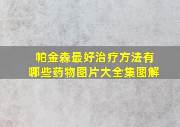 帕金森最好治疗方法有哪些药物图片大全集图解