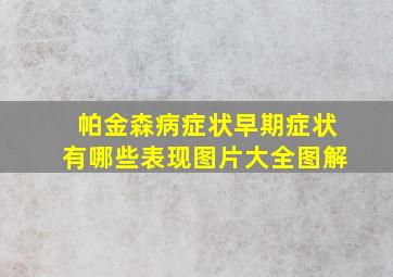 帕金森病症状早期症状有哪些表现图片大全图解