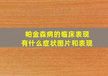 帕金森病的临床表现有什么症状图片和表现