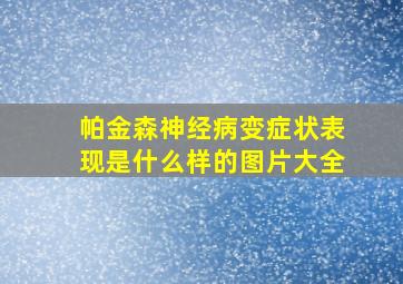 帕金森神经病变症状表现是什么样的图片大全