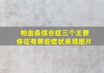 帕金森综合症三个主要体征有哪些症状表现图片