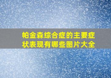 帕金森综合症的主要症状表现有哪些图片大全