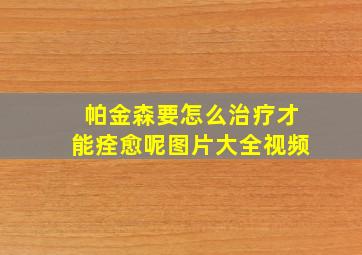 帕金森要怎么治疗才能痊愈呢图片大全视频