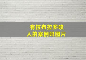 有拉布拉多咬人的案例吗图片