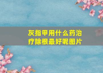 灰指甲用什么药治疗除根最好呢图片