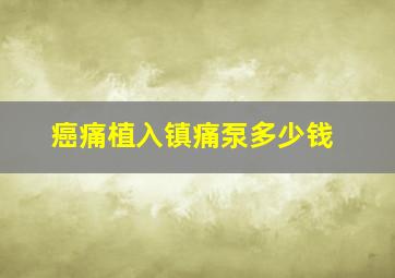 癌痛植入镇痛泵多少钱