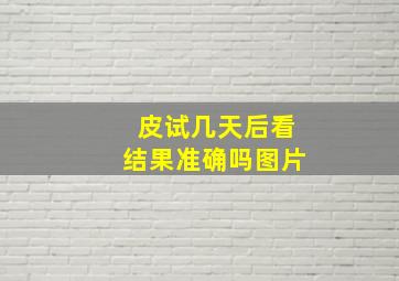 皮试几天后看结果准确吗图片