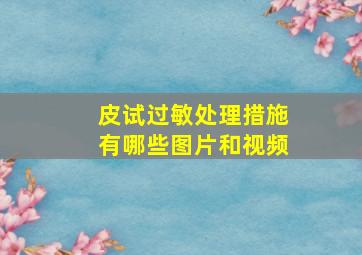 皮试过敏处理措施有哪些图片和视频