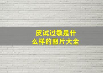 皮试过敏是什么样的图片大全