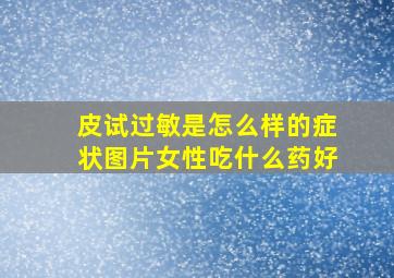 皮试过敏是怎么样的症状图片女性吃什么药好