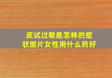 皮试过敏是怎样的症状图片女性用什么药好