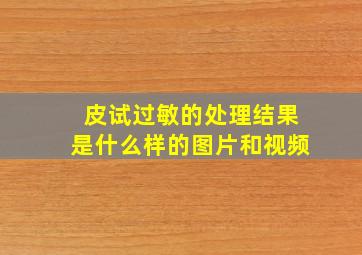 皮试过敏的处理结果是什么样的图片和视频