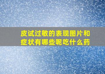 皮试过敏的表现图片和症状有哪些呢吃什么药