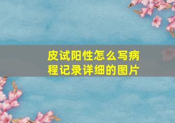 皮试阳性怎么写病程记录详细的图片