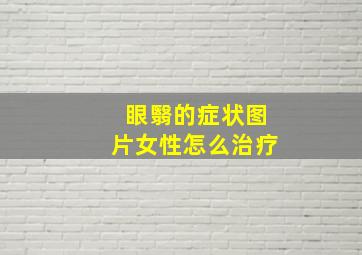 眼翳的症状图片女性怎么治疗