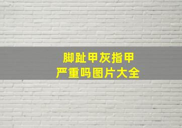 脚趾甲灰指甲严重吗图片大全