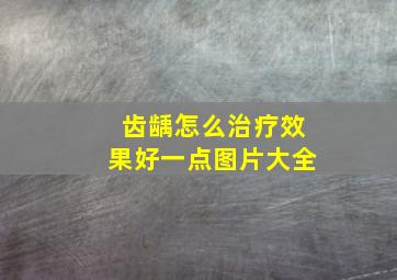 齿龋怎么治疗效果好一点图片大全