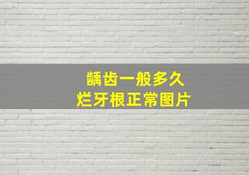 龋齿一般多久烂牙根正常图片