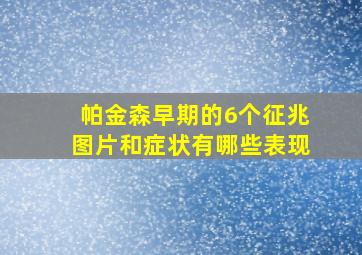 帕金森早期的6个征兆图片和症状有哪些表现