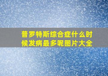 普罗特斯综合症什么时候发病最多呢图片大全